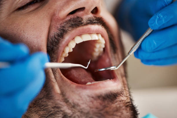 Best Emergency Dental Extractions in New Burlington, OH